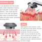 Body Face Lift Ultrasound Body Slimming Massager